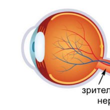 Лечение атрофии зрительного нерва народными средствами