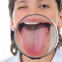 Тест: Диагностика заболеваний по языку в домашних условиях